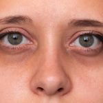 How to Reduce Dark Circles using Solimar Paris-Under Eye Cream & Serum